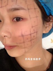 -上海漾颜医疗美容