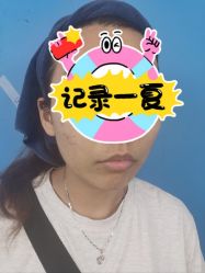 体验前-广州美莱医疗美容医院