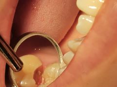 -泰康拜博口腔(世博园乐尔店)