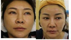 -丰联丽格医疗美容·联合丽格眼整形中心