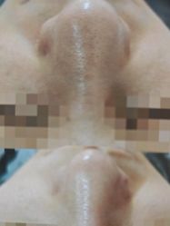 -SKIN79皮肤管理中心