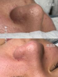 -初樱科技美学问题肌修复中心