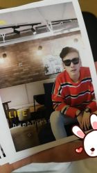 点击看大图 -大麦微针植发丨全国连锁