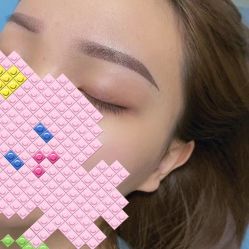 体验后-重庆联合丽格第五医疗美容医院