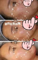 点击看大图 -ROYEA茹彦祛痘·问题肌肤修护中心
