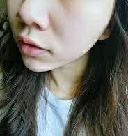 -SKINIST丽铂医疗美容