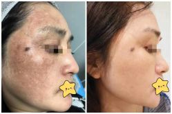 点击看大图 -瓷肌博士·祛痘科技美肤