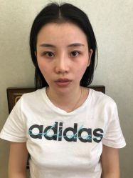 -深圳悦她医疗美容