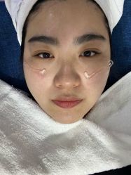 -天津健丽·去眼袋医疗美容机构