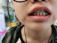 -德标艾诺口腔(敦化路店)