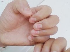 -新甲连锁灰指甲·甲沟炎·鸡眼(黑龙江路店)