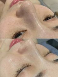 -YooMee优美智能科技美肤机构