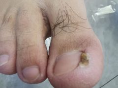 -世龙世家手足健康护理连锁(福田梅林路润裕花园店)