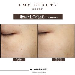 -丽美妍医疗美容·皮秒·立体分层抗衰