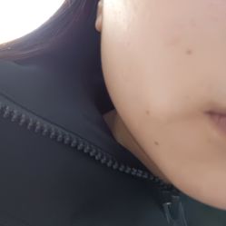 -成都大华医学美容医院