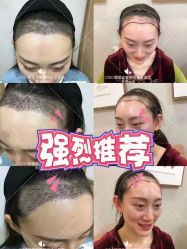 -熙朵美学植发·连锁品牌