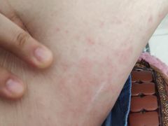 -龙达温泉生态城