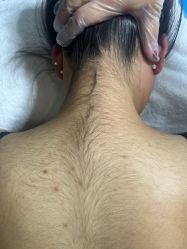 -薇兰专业脱毛连锁机构