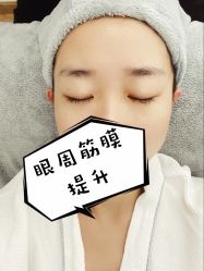 -溢美古法抗衰