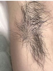 -薇兰专业脱毛连锁机构