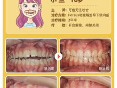 -柏乐口腔(南宁总院)