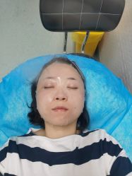 -八大处整形