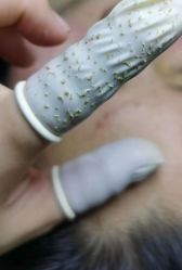 -瑶芳清颜草本祛痘