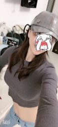 点击看大图 体验后-广州美莱医疗美容医院