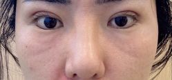 -上海华美医疗美容医院