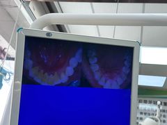 -爱牙联合口腔(门诊报销 海云庵店)