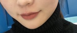 -晶奕空间专业脱毛连锁机构