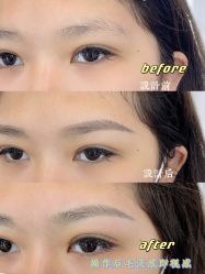 -久匠·纹眉纹绣半永久