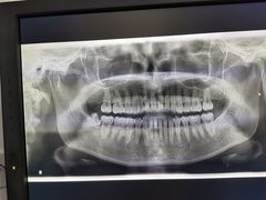 -同济大学附属同济医院分院