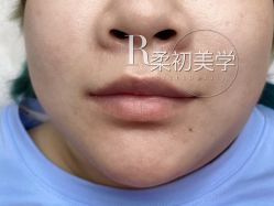 -RC半永久纹眉纹发际线