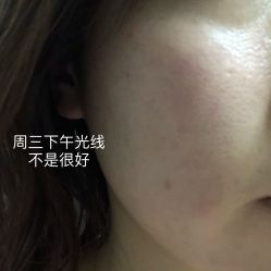 体验后-和颜一美轻医美连锁