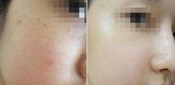 -SKINIST丽铂医疗美容
