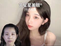 -Yestar重庆艺星医疗美容医院