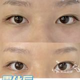 唐山探店｜眼睛喝饱水🥽时空焕活眼部雾化spa