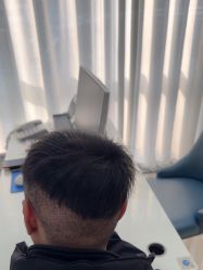 -大麦微针植发丨全国连锁