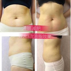 -清媚减肥瘦身纤体