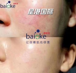 -星港国际·Skin皮肤专研·皮肤管理
