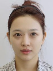 体验前-JustHer宁波珈禾医疗美容医院