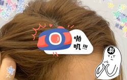 -大麦微针植发全国连锁