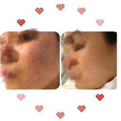 -康美贞·痘肌养护管理中心