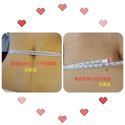 -贝美佳产后修复中心