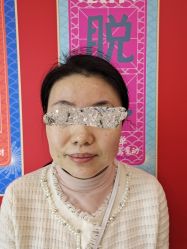 体验前-西安伊美尔医疗美容医院