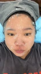 体验后-澳尔颜选医疗美容