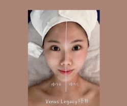 -东森自然美.INDIBA.美容SPA.皮肤管理