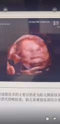 -重庆安琪儿妇产医院-妇幼保健联盟医院