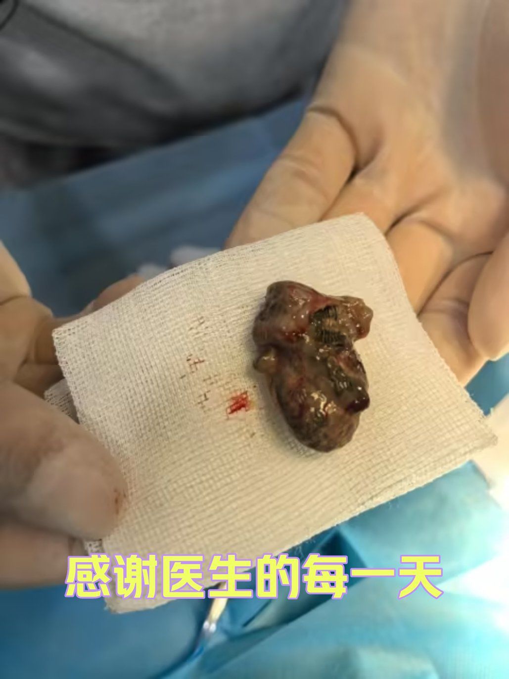 猫咪肠道异物
